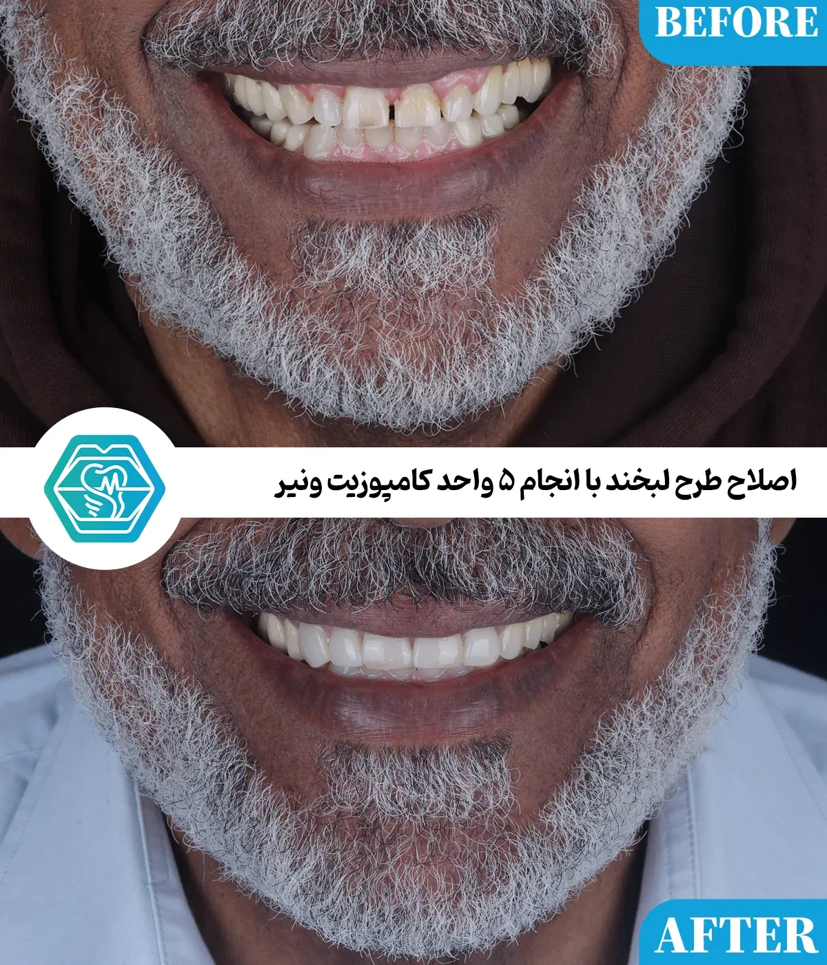 Provider-published dental treatment comparison from Negin Dental Clinic, Shiraz, example 2