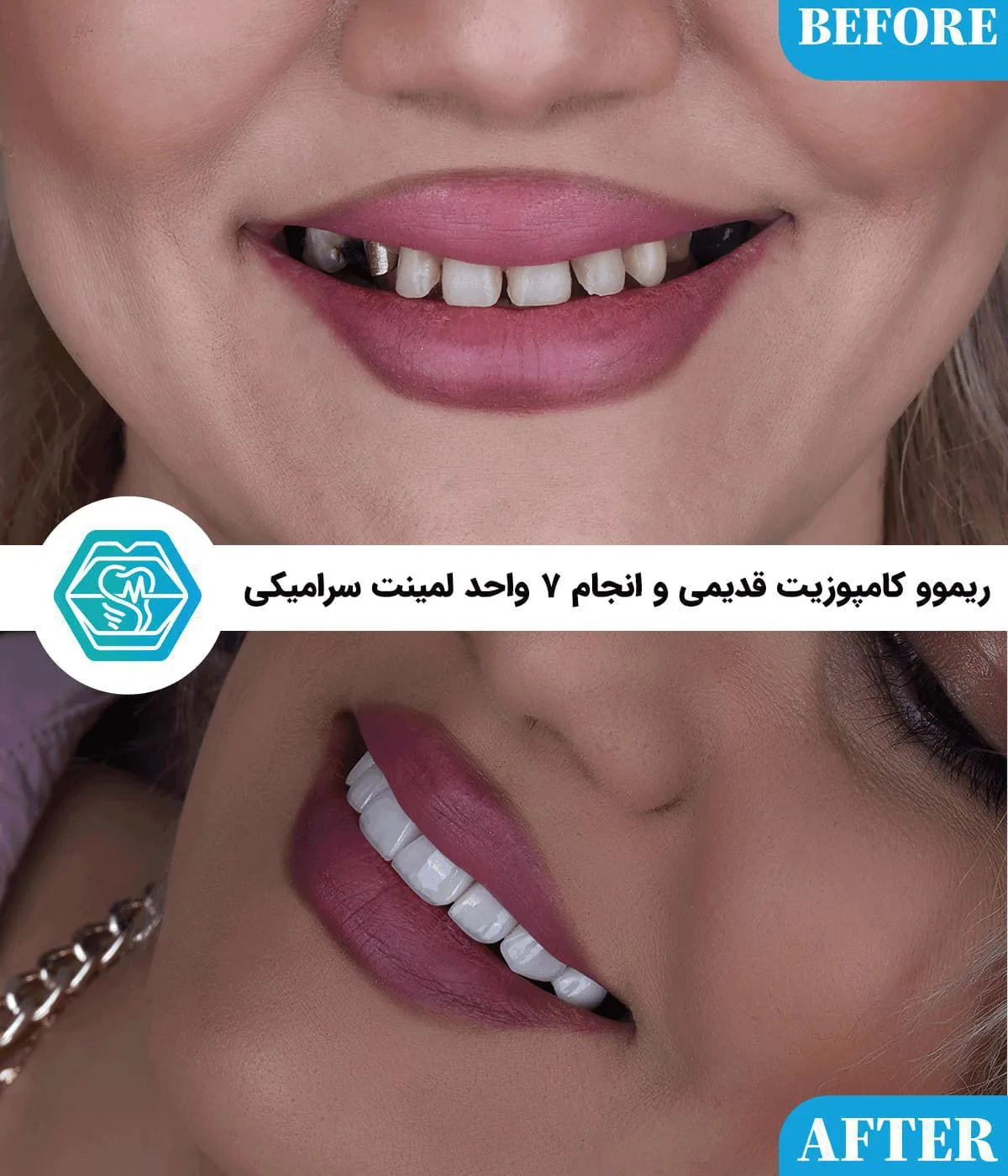 Provider-published dental treatment comparison from Negin Dental Clinic, Shiraz, example 4