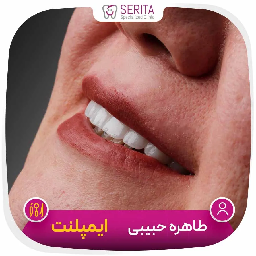 Provider-published dental treatment comparison from Serita Dental Center, example 1