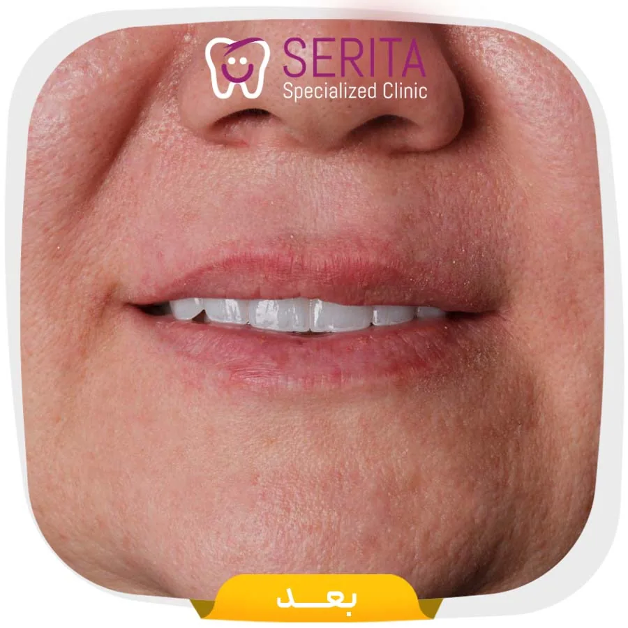 Provider-published dental treatment comparison from Serita Dental Center, example 2