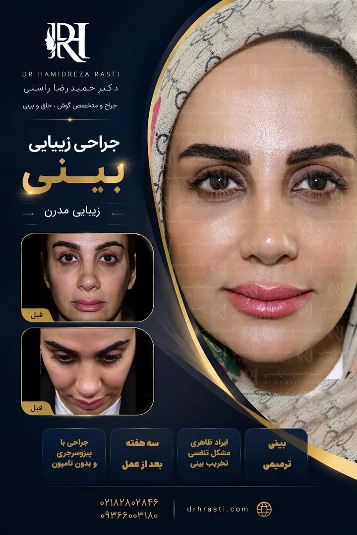 Provider-published rhinoplasty comparison image 1 from Dr. Hamidreza Rasti Boroujeni