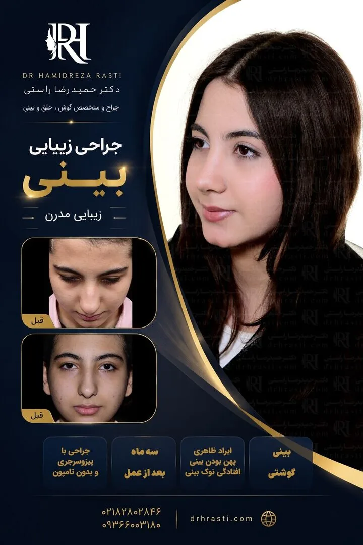 Provider-published rhinoplasty comparison image 3 from Dr. Hamidreza Rasti Boroujeni