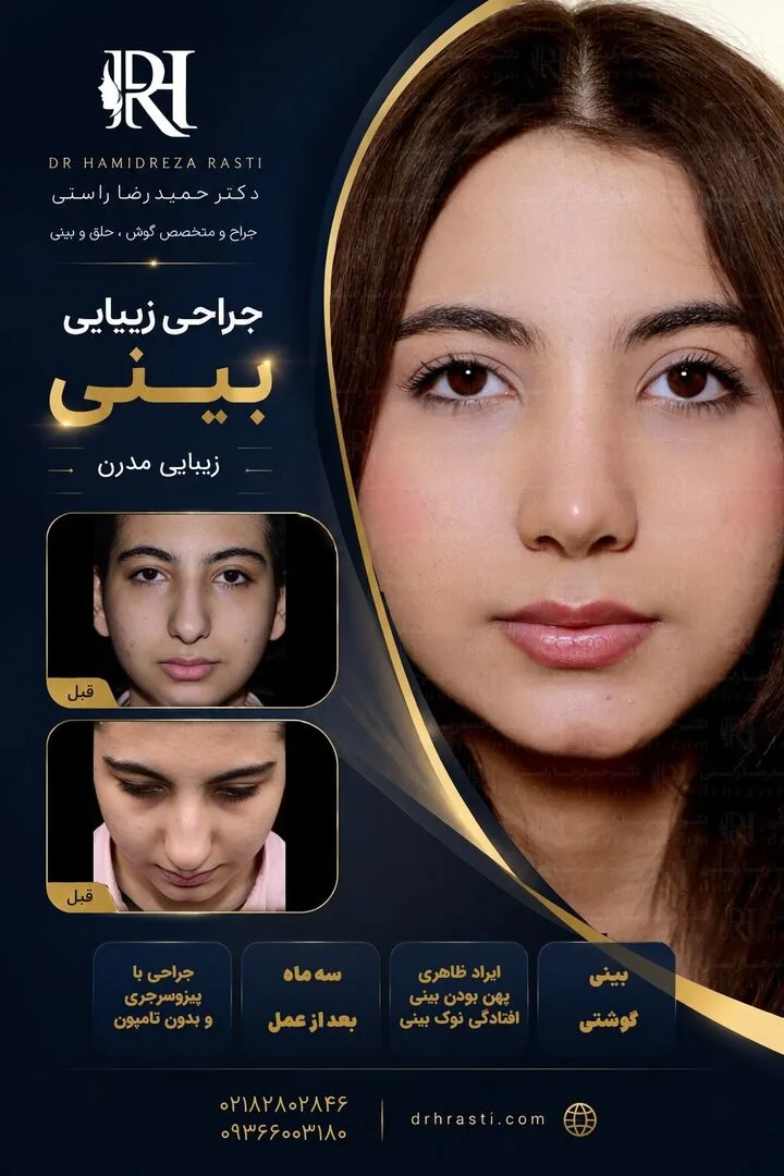 Provider-published rhinoplasty comparison image 4 from Dr. Hamidreza Rasti Boroujeni