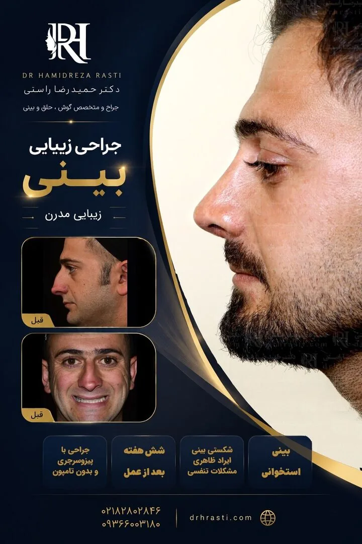 Provider-published rhinoplasty comparison image 5 from Dr. Hamidreza Rasti Boroujeni