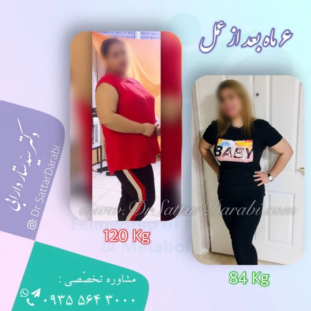 Provider-published weight-loss before and after example 2 from Dr Seyed Sattar Darabi