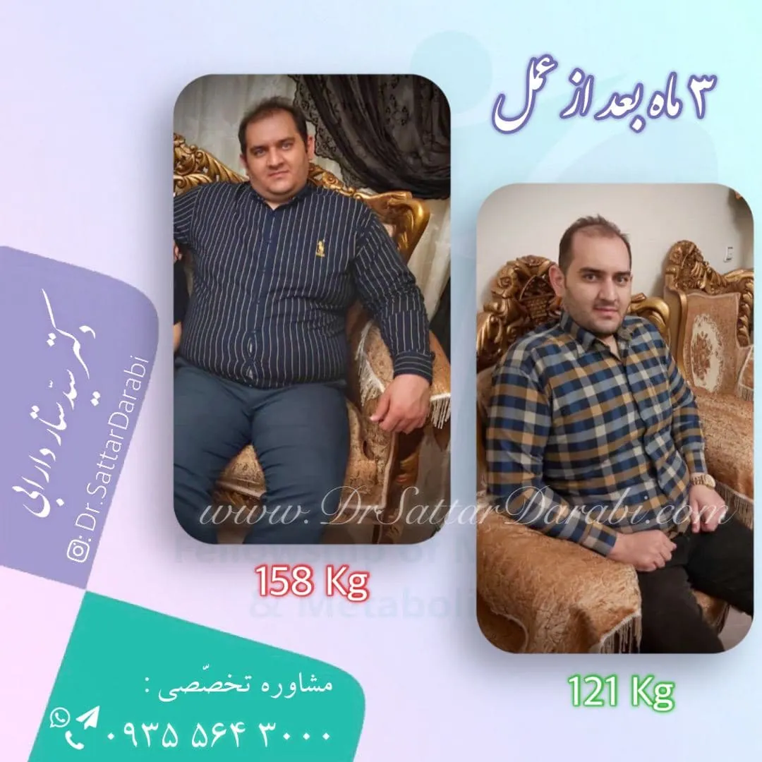 Provider-published weight-loss before and after example 3 from Dr Seyed Sattar Darabi