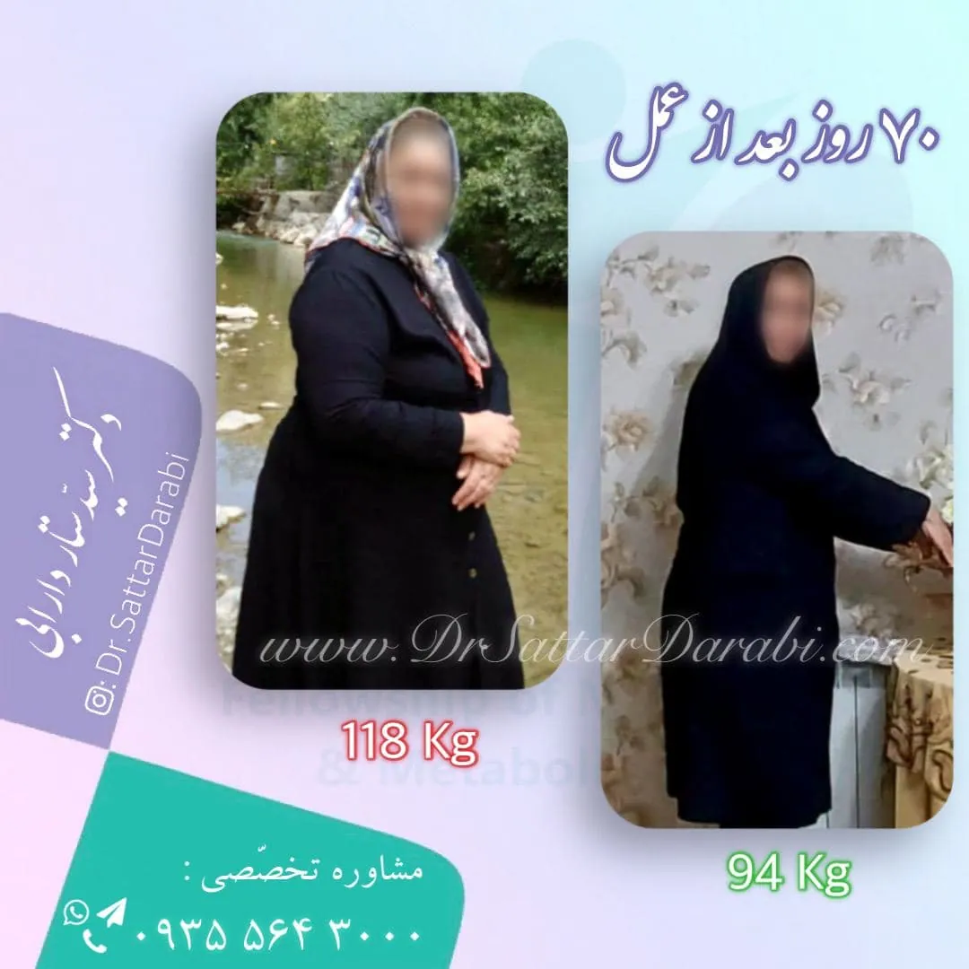 Provider-published weight-loss before and after example 6 from Dr Seyed Sattar Darabi