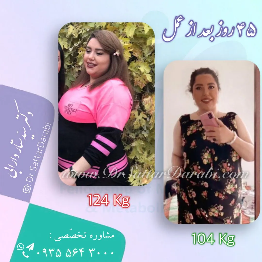 Provider-published weight-loss before and after example 10 from Dr Seyed Sattar Darabi