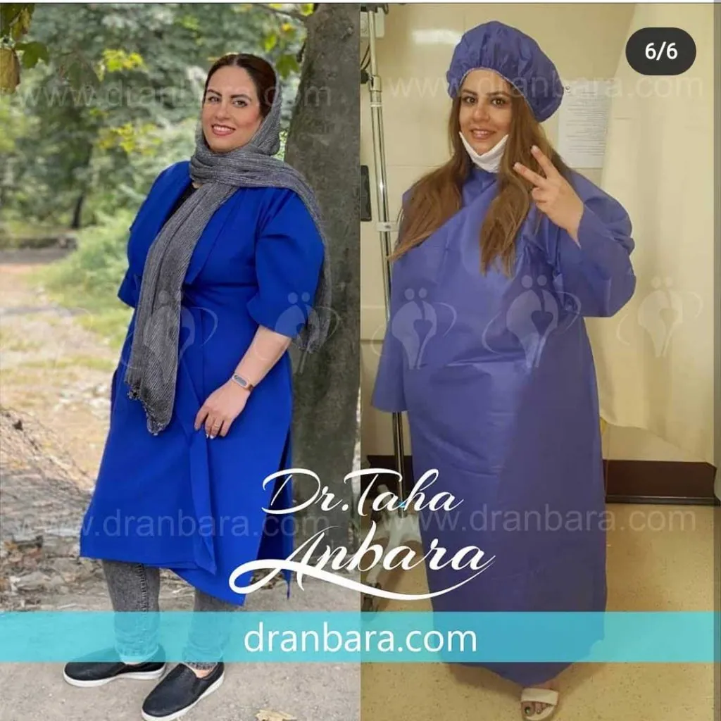 Provider-published weight-loss before and after example 14 from Dr Taha Anbara