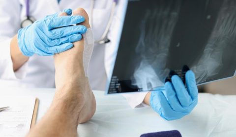 تعویض مفصل الكاحل في إيران: دليل شامل 2025