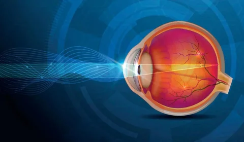 دليل عملية الماء الأزرق في إيران