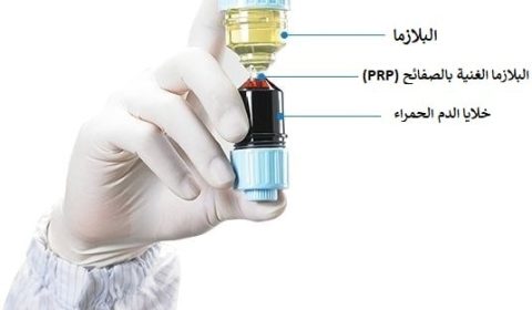حقن البلازما الغنية بالصفائح في إيران مع همينتور: بشرة نضرة وشعر كثيف