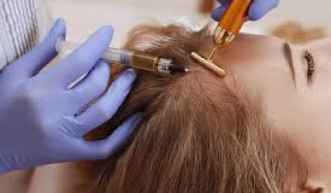 ميزوثيرابي الشعر: طرق حقن لإعادة بناء وتغذية البصيلات مع همینتور