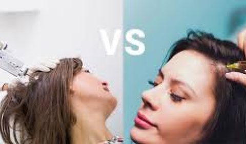 مقارنة بين PRP والميزوثيرابي: أي طريقة حقن أكثر فاعلية؟