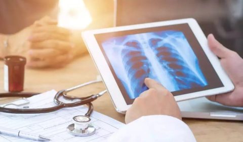 السياحة الطبية في إيران: فهم وعلاج أمراض الرئة وطرق الوقاية منها مع همينتور