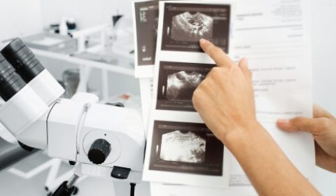 كم تستغرق عملية تنظيف الرحم؟