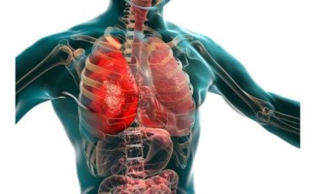 هل الالتهاب الرئوي معدٍ؟ دليلك لـ "أسرار" العدوى والوقاية!
